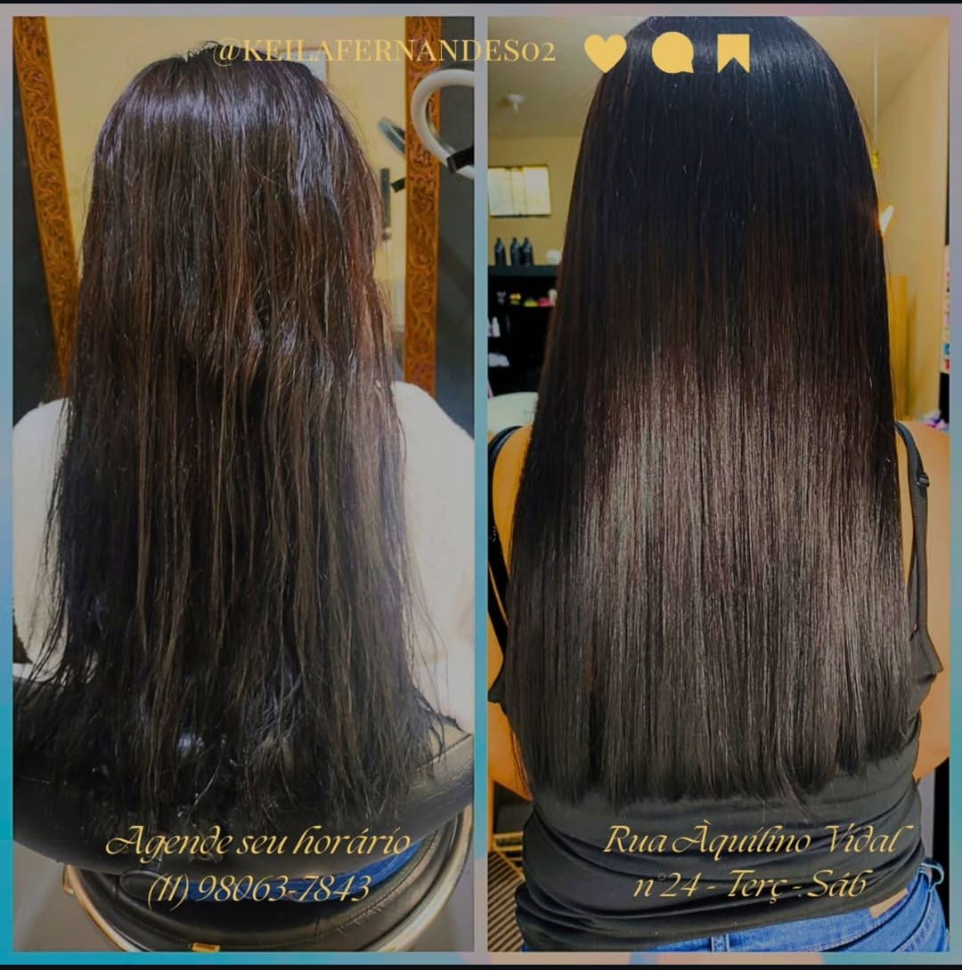 Imagem do serviço de Progressiva